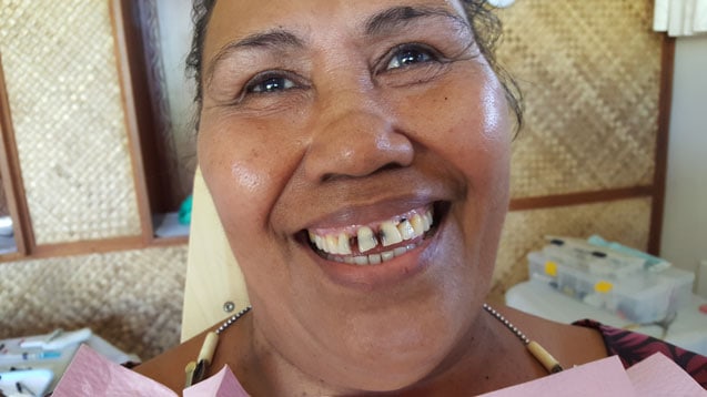 samoa dental project