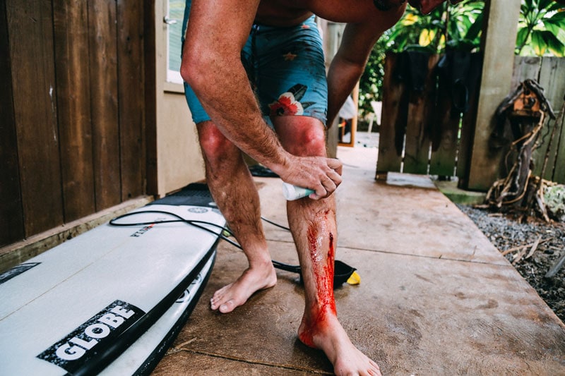 active skin repair damien hobgood fin gash